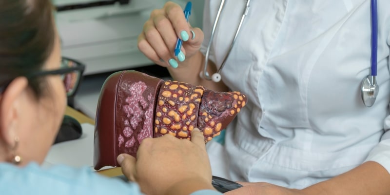 Uma médica mostrando a gordura no fígado de um modelo para uma paciente.