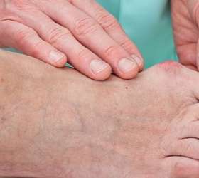 Joanete: conheça 5 tratamentos caseiros para se livrar do problema